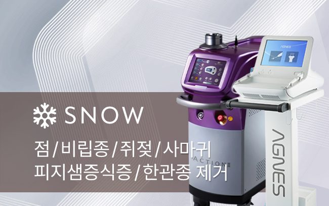 점 쥐젖 사마귀 제거